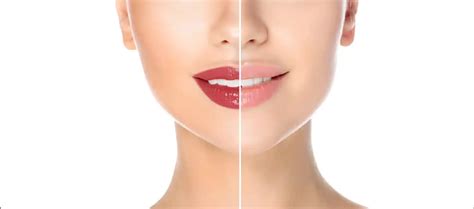 Lip Tattoo Removal - Permanent Makeup Studio in Dubai