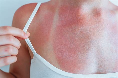 Common Breast Skin Problems And How To Treat Them Safely