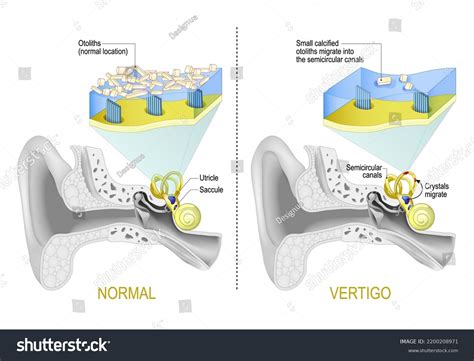 Otoliths Ear