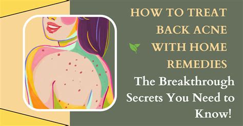 How To Treat Back Acne With Home Remedies