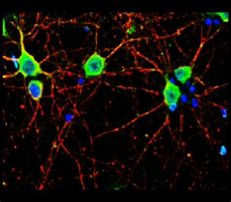 Neurodegeneration Antibody Panel Irap Ireal Biotechnology Inc