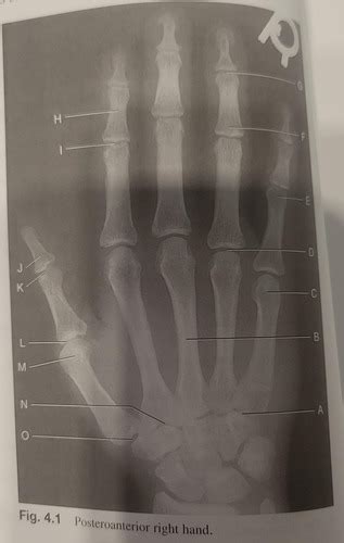 Posteroanterior Right Hand Flashcards Quizlet