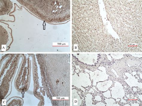 Strong Immunoreactivity Arrowed For Interleukin 6 Il 6 In A The Download Scientific