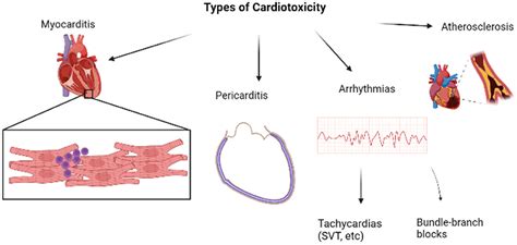 Frontiers Cardiotoxicity Induced By Immune Checkpoint Inhibitor The