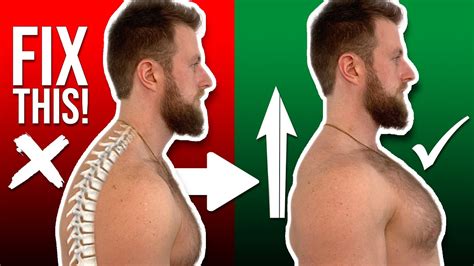 Posture Correction Exercises | The 5 BEST Ones You Can Do At HOME! - GuerrillaZen Fitness