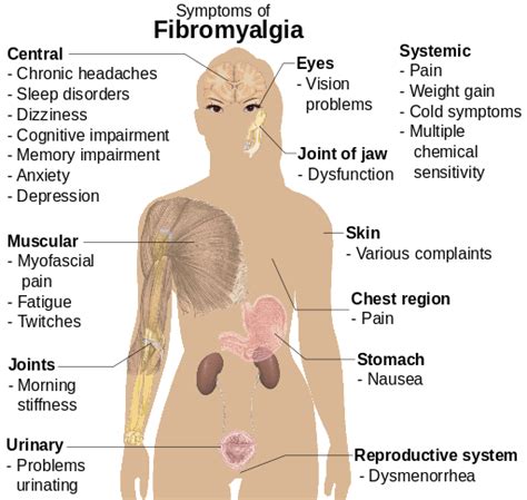 Myalgia | Current Health Advice, Health Blog Articles and Tips