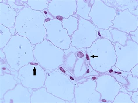 Tecido Adiposo Unilocular - Tecido Adiposo – Histologia Interativa