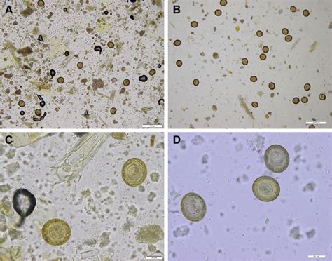 Eggs of Hymenolepis diminuta found in the African green monkeys. Scale ...