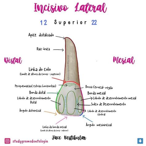 Vestibular Do Incisivo Lateral Superior Anatomia Anatomiadental