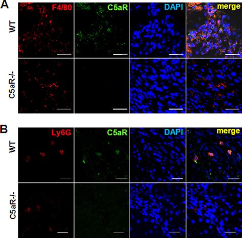 C Ar Protein Expression In Tumor Infiltrating Macrophages And