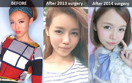 Hot girl Singapore bị chỉ trích vì ham phẫu thuật thẩm mỹ