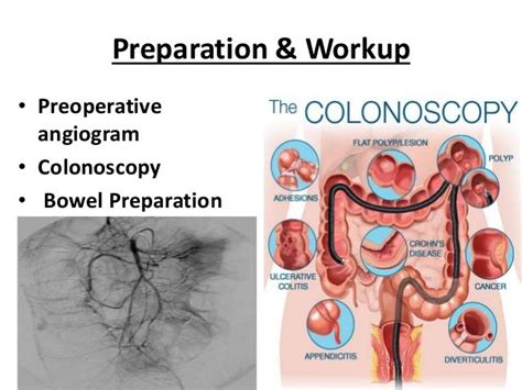 Conduits After Esophagectomy For Esophageal Reconstruction