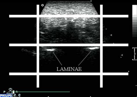 Figure From Stability And Intra Tester Reliability Of An In Vivo