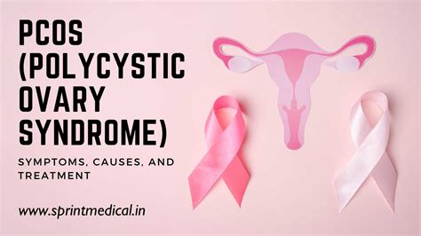 Pcos Polycystic Ovary Syndrome Symptoms Causes And Treatment