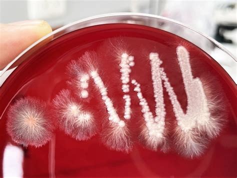 Microscopic And Macroscopic Characteristics Of Fungi