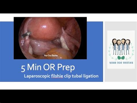 Min Operating Room Prep Laparoscopic Filshie Clip Tubal Ligation