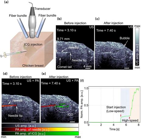 Harmonic US And PA Dual Modal Imaging For Needles Guidance With ICG