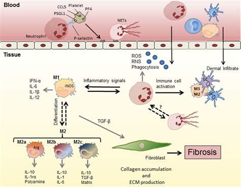 Early Inflammatory Players In Cutaneous Fibrosis Journal Of