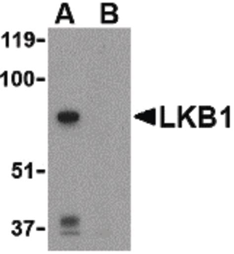 Ihc Plus Stk Lkb Polyclonal Antibody Rabbit Anti Human Lsbio