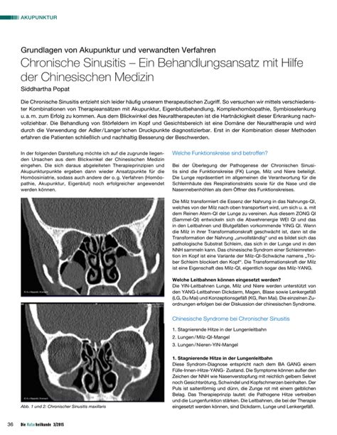 Chronische Sinusitis Ein Behandlungsansatz Mit Hilfe Der