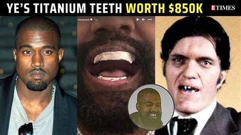 Kanye West debuts $850K titanium teeth inspired by James Bond villain ...