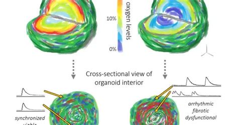 Nature子刊：培养皿里的心肌梗死模型心肌梗死新浪新闻