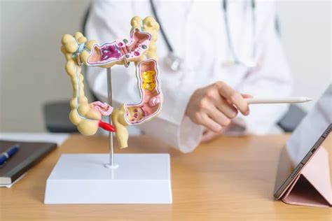 Doctor con modelo y tableta de anatomía humana de Colon Enfermedad de