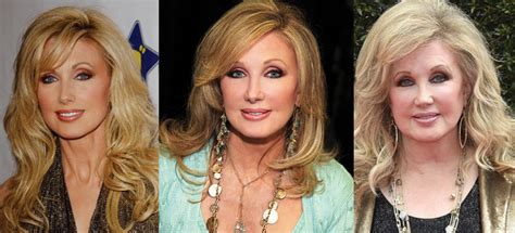 Morgan Fairchild Plastic Surgery Before And After Pictures 2024