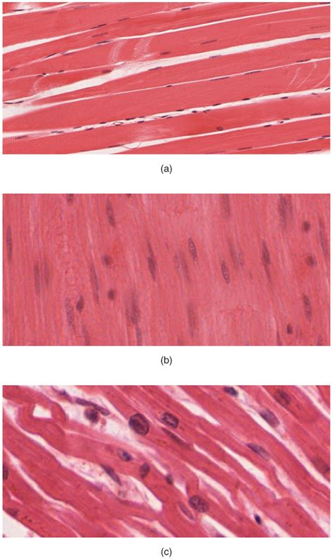 Types of Muscle Tissue | Physiology | Geeky Medics