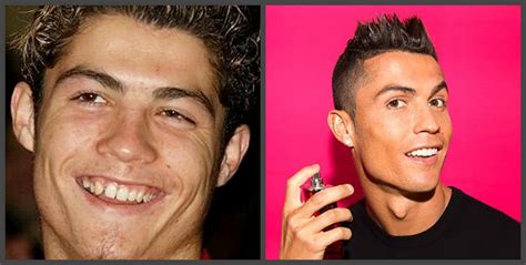 Cristiano Ronaldo Before After