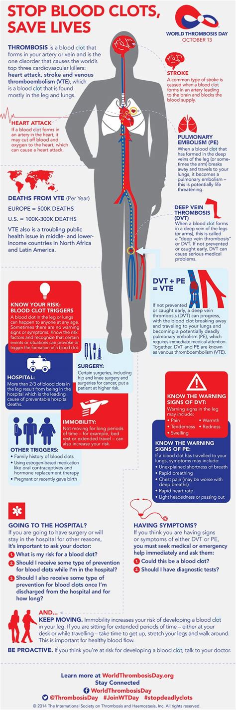 Pulmonary Embolism And Blood Clots From Flying Long Haul Flights