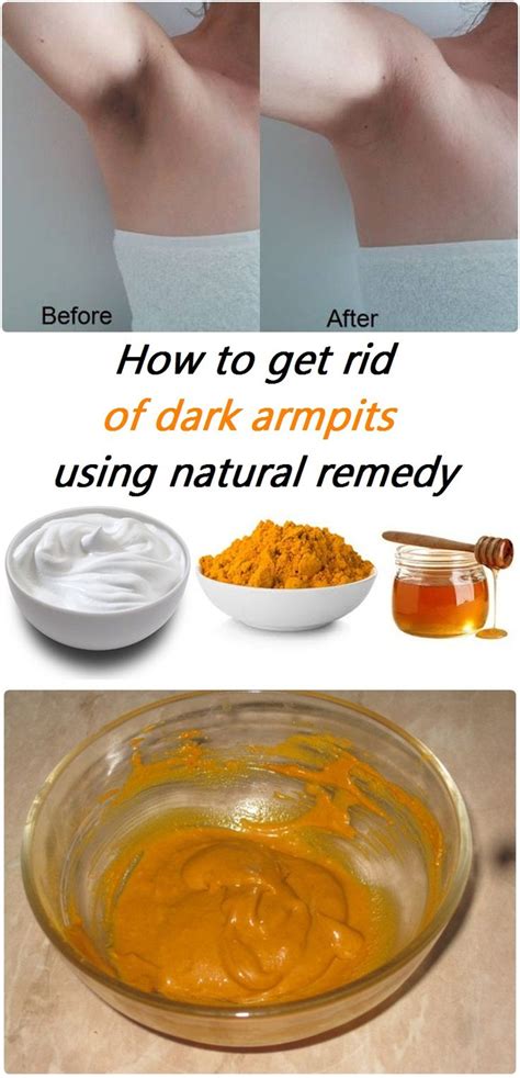 How To Get Rid Of Dark Armpits Using Natural Remedy Beauty