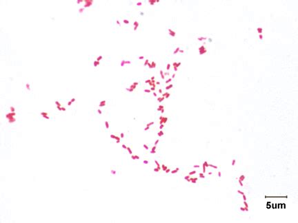 Salmonella Gram Stain