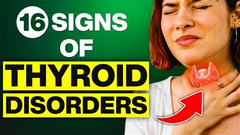 16 Signs Of Thyroid Disorders You Should Not Ignore Hypothyroidism And Hyperthyroidism Youtube