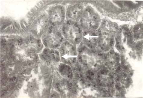 Hepatopancreas Of Archachatina Marginata Hepatic Foci Of Cellular Download Scientific Diagram