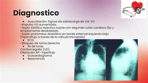 Cardiopatia Congenitas Clasificacion Presentacion Clinicas Y