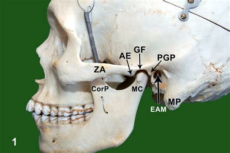 Lateral View Of Dry Skull Za Zygomatic Arch Ae Articular Eminence Download Scientific