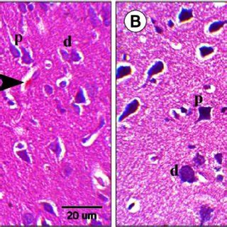 H&E (x400): Sections in the rat cerebral cortex of group I showing (A ... 