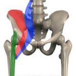 how to know if you strained your hip flexor
