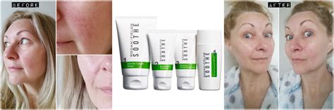 Rosacea Reviews Rodan Fields Soothe Regimen By Coar