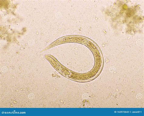 Strongyloides In Stool