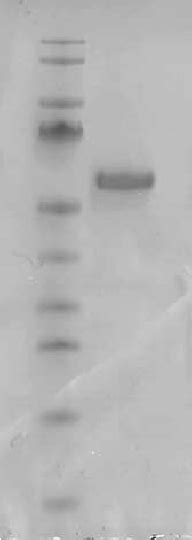 SDS PAGE Gel Of 6H TR Lane 1 PageRuler Prestained Protein Ladder