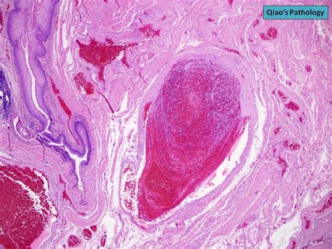 Flickriver Qiao S Pathology Art And Science In Medicine S Photos