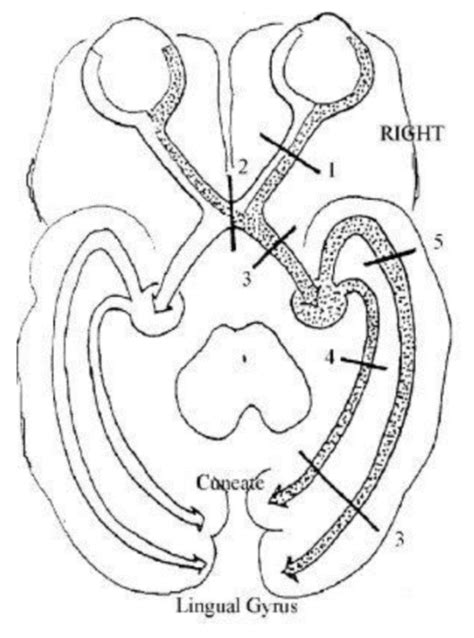 Optic tract anatomy Diagram | Quizlet