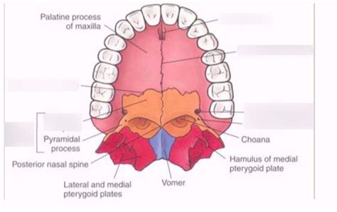 maxilla & palatine bone (slide 21) Diagram | Quizlet 