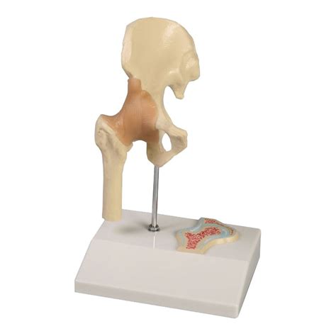 Life Size Hip Joint Anatomical Model Hab Direct