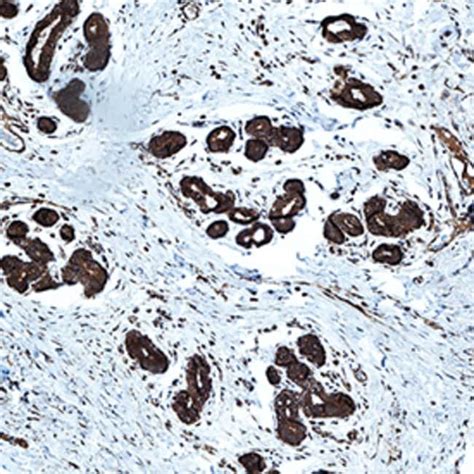 Human IFN beta Antibody R D Systems 25 μg Unconjugated Fisher