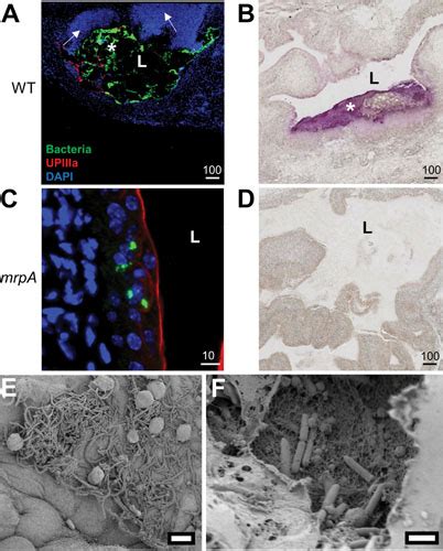 Pathogenesis Of Proteus Mirabilis Infection Ecosal Plus