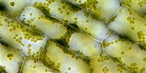 Elodea Cells Under A Microscope