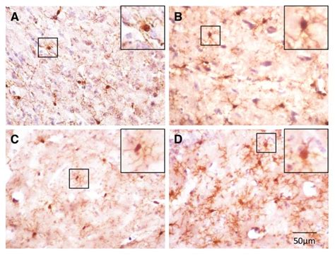 Brain Region Specific Alterations In The Gene Expression Of Cytokines